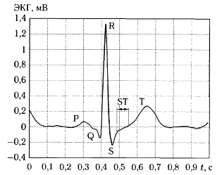 ЭКГ: описание, норма и признаки патологий