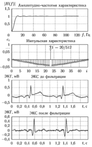Слева: амплитудно-частотная и импульсная характеристики ФВЧ; справа: пример фильтрации ЭКГ